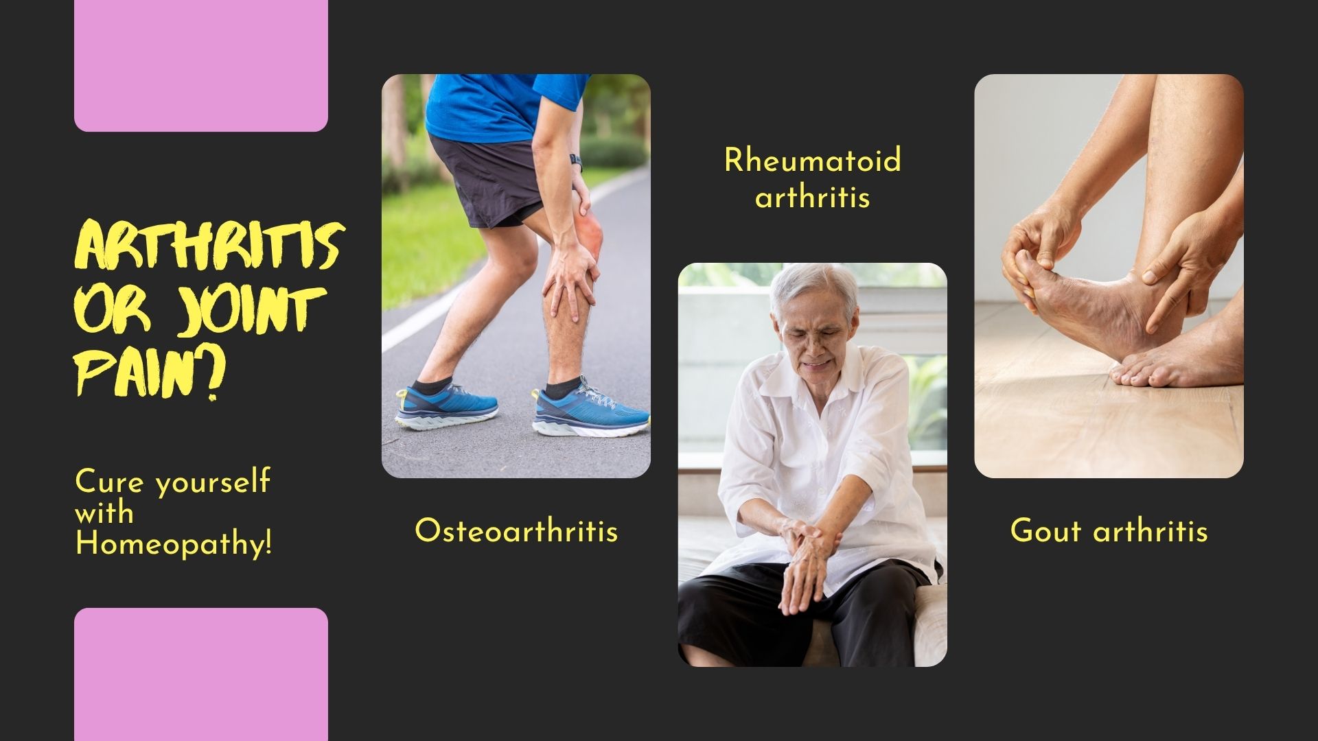 Arthritis